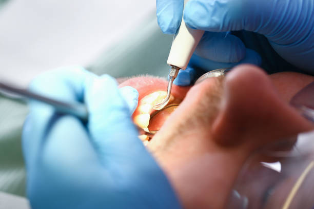 Best Walk-In Emergency Dental Services in Deerfield, IL