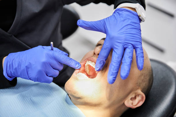 Best Knocked-Out Tooth (Avulsed Tooth) Treatment in Deerfield, IL